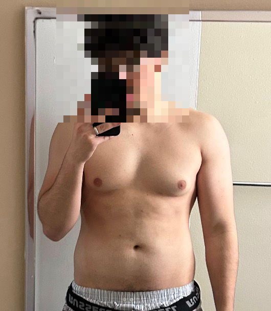 Amine before