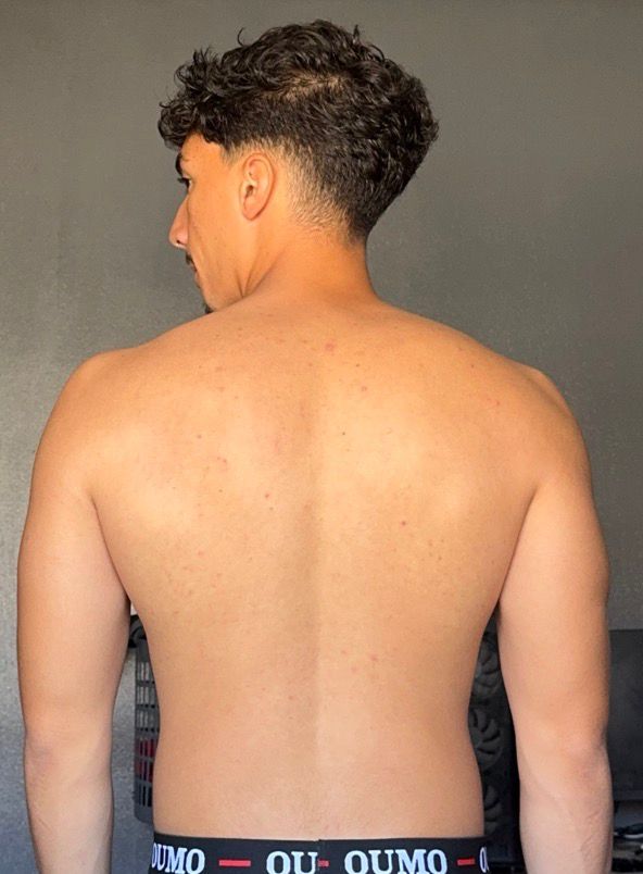 Abdelalime after back
